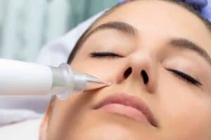 Actinic keratoses Rutland solutions - book in today!