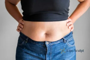 Bidding Farewell to Muffin Tops with Aqualyx Fat Injections 2 Do you wish you could reduce your muffin top Rutland With Aqualy fat dissolving injections you can!