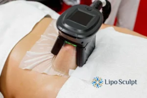 Does Fat Freezing At Home Work? 3 Fat freezing at home from Lipo Sculpt Rutland